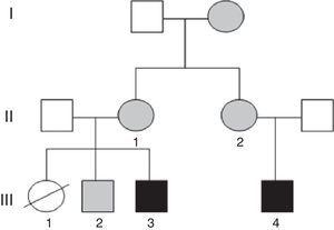 Pedigree chart of the individuals presented in this article. In black: individuals with unbalanced translocation and intellectual disability. In grey: individuals with balanced translocations (III.3=case 2; III.4=case 1).