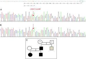 Mutazione nuova rilevata nel gene GDF5. (A) Sequenza genica dell'esone 2 nel probando, che mostra una mutazione c.1462AT che risulta in un codone di stop prematuro e una proteina troncata (p.Lys488*) (abbiamo indicato la posizione normale del codone di stop con un quadrato verde). (B) Sequenza normale della stessa regione nella madre sana. (C) Pedigree della famiglia: il padre ed entrambi i figli, in nero, hanno una mutazione confermata in GDF5. La madre sana appare in bianco. Il quadrato grigio rappresenta uno zio paterno con polidattilia bilaterale post-assiale che probabilmente ha la mutazione.