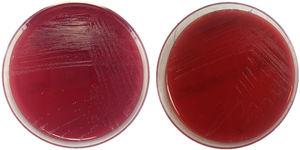Picture of Actinotignum schaalii colonies in culture media. Growth in blood agar after 48h of culture under anaerobic conditions (left) and aerobic conditions (right).