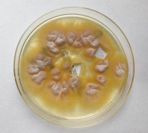 Appearance of Arthroderma benhamiae growth in Sabouraud agar plate.