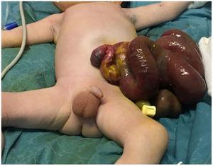 Patient at birth.