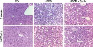 H&E stained liver sections 20× from representative mice fed with CD diet (CD) and mice fed high-fat choline-deficient diet (HFCD) diet or high-fat choline-deficient diet plus Synbiotic, as detailed in Methods. HFCD diet and HFCD diet+Synb showed aspects of steatohepatits at 6 and 18 weeks that were not present in mice undergoing CD diet. The addition of Synb did not abrogate these aspects.