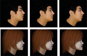 Imágenes de perfil facial modificadas en el tercio inferior de la cara por un software para obtener los perfiles recto, cóncavo y convexo.