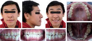 Facial and intraoral photographs.