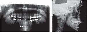 Initial panoramic radiograph and lateral headfilm.