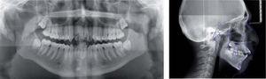 Initial panoramic radiograph and lateral head film.