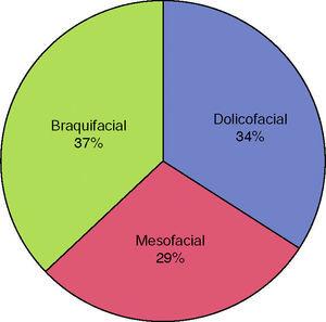 Percentile representation of the population??s facial biotypes according to VERT. Source: Direct.