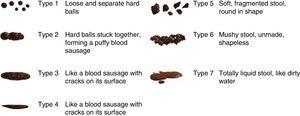  Bristol-Skala für faeces assessment. Visuelle Tabelle mit Illustrationen. Quelle: Lewis und Heaton.32