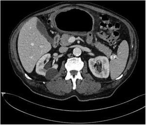 Cross-sectional CT.
