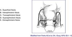 Parks classification of fistulas.