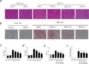 HZFGG attenuates MCD-induced liver steatosis and injury in mice. Representative photos of histological. (a) H&E and (b) oil red O staining in chow diet or MCD diet mice with or without HZFGG treatment. The levels of (c) TNF-α, (d) IL-1β and (e) GPx in chow diet or MCD diet mice with or without HZFGG treatment. (f) The NAFLD activity score (NAS) which was calculated by steatosis, hepatocyte ballooning and lobular inflammation in chow diet or MCD diet mice with or without HZFGG treatment. The data were presented as the mean±SD and **P<0.01 vs control group, #P<0.05 vs model group.