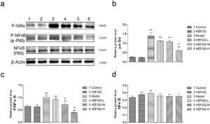HZFGG blocked the activation of the NF-kB signaling pathway. (a) Western blotting analysis results of p-IκBa, p-NF-κB and NF-κB proteins in control group, HZFGG group, MCD diet group, MCD diet groups with HZFGG treatment, β-actin was used as the loading control. Results of quantification analysis of (b) p-IκBa, (c) p-NF-κB and (d) NF-kB proteins in chow diet or MCD diet mice with or without HZFGG treatment. The data were presented as the mean ± SD and **P<0.01 vs control group, #P<0.05 vs model group.
