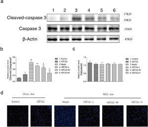 HZFGG ameliorates hepatocyte apoptosis induced by an MCD diet in mice. (a) Western blotting analysis results of cleaved-caspase-3 and caspase-3 proteins in control group, HZFGG group, MCD diet group, MCD diet groups with HZFGG treatment, β-actin was used as the loading control. Results of quantification analysis of (b) cleaved-caspase-3 and (c) caspase-3 proteins in chow diet or MCD diet mice with or without HZFGG treatment. (d) Representative photos of TUNEL staining in chow diet or MCD diet mice with or without HZFGG treatment. The data were presented as the mean±SD and **P<0.01 vs control group, #P<0.05 vs model group.
