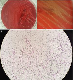 (A) Culture in Wilkins–Chalgren agar. (B) Gram stain.