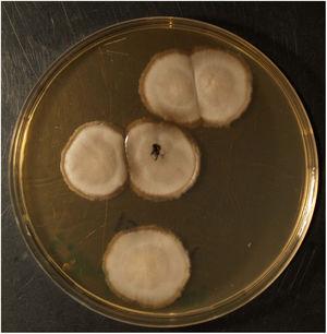 White colony with evolution to darker areas in Sabouraud medium with gentamicin and chloramphenicol. Incubation at 30 °C.
