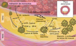 Efectos de vitamina D en aterosclerosis.