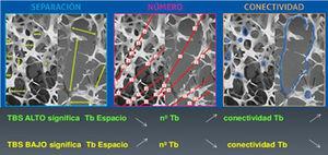 Correlación de TBS con los parámetros de microarquitectura ósea. Tomada de Del Río et al.11.