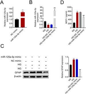 Forced miR-125a-5p repressed astrocytic activation post high glucose treatment. (A) Transfection efficiency of miR-125a-5p in astrocytes. (B) Expression of miR-125a-5p in astrocytes treated with high glucose after transfection with miR-125a-5p mimic. (C) Expression of GFAP in astrocytes treated with high glucose after transfection with miR-125a-5p mimic. (D) Expression of MCP-1 in astrocytes treated with high glucose after transfection with miR-125a-5p mimic. **, ## p<0.01.