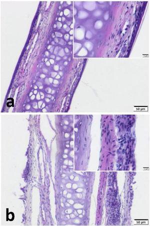 Cartilagem septal coberta de mucopericôndrio. A celularidade aumentada e o edema subepitelial são notáveis no grupo de ratas grávidas. (a) grupo controle (b) grupo grávida (coloração H&E) (escala=50μm e 10μm).