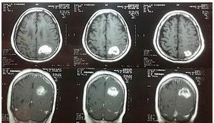 Contrast nuclear magnetic resonance imaging.