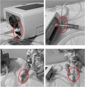 Top left hand photograph demonstrated that oxygen should be entrained using a dedicated connector where possible (circled). If this is not possible the top right hand photograph illustrates the position of an oxygen connector attached to the ventilator tubing (circled). It can also be placed on, before intentional leak (bottom left photograph) or before the “active valve”, bottom right photograph.