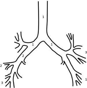 Location of the 14 EHs in the tracheobronchial tree: trachea - 1; right main bronchus - 1; intermediate bronchus - 2; middle lobe bronchus - 2; right lower lobe bronchus - 3; left main bronchus - 1; left upper lobe bronchus - 3; and left lower lobe bronchus - 1.
