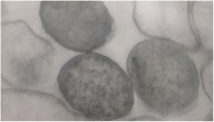 Fotomicrografia eletrônica de transmissão de uma colônia de Bartonella henselae (ATCC 49793) após 45 dias de crescimento em ágar enriquecido com sangue: bactérias cocoides e eletrondensas com parede trilaminar, 50.000×.