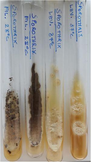 Tubos de cultura em ágar Sabouraud. Forma filamentosa (25°C) com colônias membranáceas de cor cinza a negro. Forma leveduriforme (37°C) com colônias cremosas de cor bege e sulcadas a partir do centro.