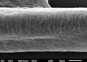 Microscopia eletrônica de varredura – exame dos cabelos. Grande aumento mostrando discreta desorganização da cutícula (900×).