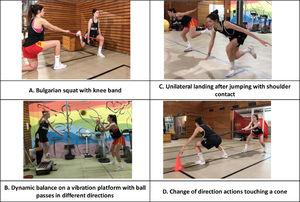 Tasks created to optimize low limb biomechanics (triple flexion of the hip-knee-ankle complex). This neuromuscular activation strategy improves quadriceps-hamstring coactivation and reduce dynamic knee valgus. This fact reduces joint load to which the knee is subjected during high-risk ACL injury actions (changes of direction, decelerations, and jump receptions). In addition to triple flexion of the low limb, flexion of the trunk is also important while maintaining the physiological curvature of the spine.