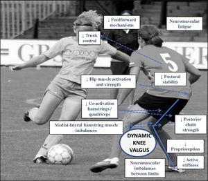 Relationship between dynamic knee valgus (dynamic knee control strategy where the frontal plane predominates) and associated neuromuscular injury risk factors.