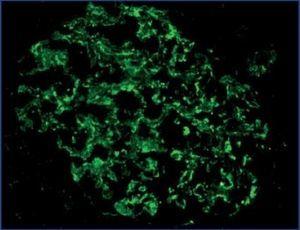 Expresión De Nefrina, Podocina Y α-actinina-4 En Tejido Renal De ...