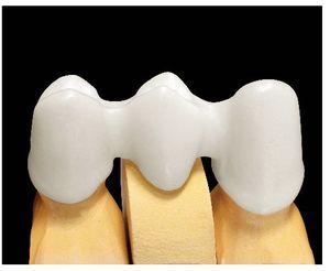 Variedad de materiales en la tecnología CAD/CAM | Quintessence Técnica