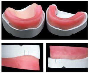 Confección De Una Prótesis Superior E Inferior Completa Con Dientes ...