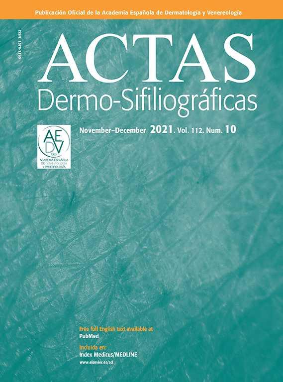 Moderate Psoriasis: A Proposed Definition | Actas Dermo ...