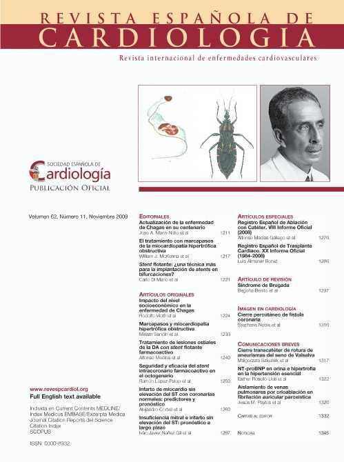 Revista Española De Cardiología 4658